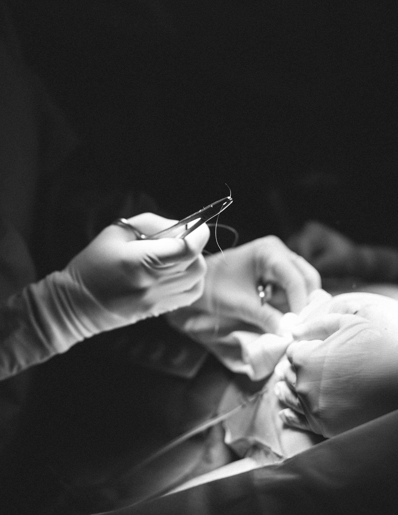 Black and white photo during plastic surgery. Photography by Laura Divella
